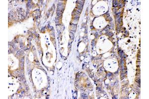 Immunohistochemistry (IHC) image for anti-Abhydrolase Domain Containing 5 (ABHD5) (AA 169-349) antibody (ABIN4886411)
