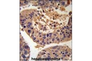 Immunohistochemistry (Paraffin-embedded Sections) (IHC (p)) image for anti-Alanine Glyoxylate Aminotransferase (AGXT) (AA 96-125) antibody (ABIN390393)