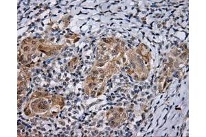 Immunohistochemical staining of paraffin-embedded Kidney tissue using anti-LIPG mouse monoclonal antibody. (LIPG 抗体)
