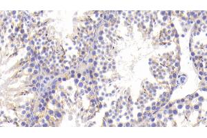 Detection of MAP1B in Mouse Testis Tissue using Polyclonal Antibody to Microtubule Associated Protein 1B (MAP1B) (MAP1B 抗体  (AA 2203-2464))