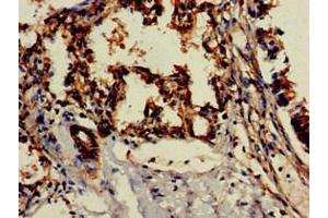 Immunohistochemistry of paraffin-embedded human lung tissue using ABIN7147139 at dilution of 1:100 (ITGB1 抗体  (AA 297-380))