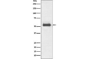 Western blot analysis of TRK fused gene expression in HeLa cell lysate.