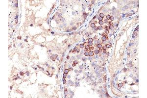 Formalin-fixed, paraffin-embedded human Testicular Carcinoma stained with MAGE-1 Mouse Monoclonal Antibody (MA454). (MAGEA1 抗体)