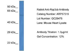 Western Blotting (WB) image for anti-Protein Phosphatase 3, Catalytic Subunit, beta Isozyme (PPP3CB) (C-Term) antibody (ABIN785907) (PPP3CB 抗体  (C-Term))