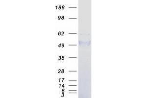 Western Blotting (WB) image for Transcobalamin I (Vitamin B12 Binding Protein, R Binder Family) (TCN1) protein (Myc-DYKDDDDK Tag) (ABIN2734126)