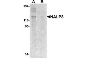 Western blot analysis of NALP8 in human colon tissue lysate with NALP8 antibody at 1 μg/ml in (A) the absence and (B) the presence of blocking peptide. (NALP8 抗体  (N-Term))
