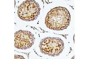 IHC analysis of SOX15 using anti-SOX15 antibody (ABIN6719624). (SOX15 抗体  (AA 1-233))