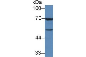 Rabbit Capture antibody from the kit in WB with Positive Control: Human MCF7 cell lysate.