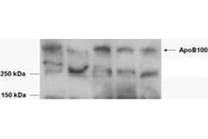 Western Blotting (WB) image for Apolipoprotein B (APOB) peptide (ABIN369954) (Apolipoprotein B (APOB) Peptide)