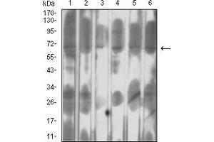 Western Blotting (WB) image for anti-SET Domain Containing (Lysine Methyltransferase) 7 (SETD7) (AA 107-366) antibody (ABIN7193393)