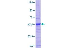 Image no. 1 for CD3d Molecule, delta (CD3-TCR Complex) (CD3D) (AA 1-171) protein (GST tag) (ABIN1348627)