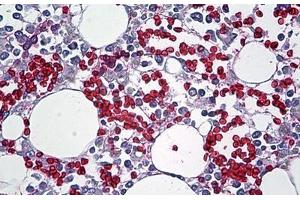 Human Bone Marrow: Formalin-Fixed, Paraffin-Embedded (FFPE) (Red Blood Cell 抗体)