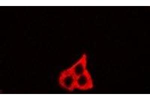 Immunofluorescent analysis of GM130 staining in U2OS cells. (Golgin A2 (GOLGA2) 抗体)