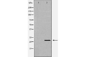 Western blot analysis of extracts of mouse livertissue, using IFNA1 antibody. (IFNA1 抗体  (Internal Region))