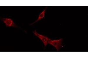 ABIN6276222 staining  MCF7 cells by IF/ICC. (TAS2R16 抗体  (Internal Region))