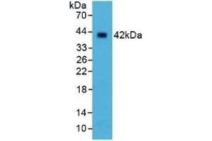 Detection of SELL in Human Liver Tissue using Polyclonal Antibody to Selectin, Leukocyte (SELL) (L-Selectin 抗体  (AA 109-346))