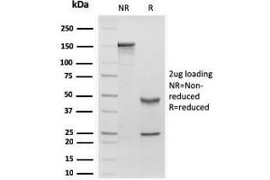 SDS-PAGE Analysis Purified RBP1 Recombinant Mouse Monoclonal Antibody (rRBP1/872). (Recombinant RBP4 抗体)