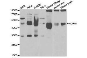 Western Blotting (WB) image for anti-N-Myc Downstream Regulated 1 (NDRG1) antibody (ABIN1873849) (NDRG1 抗体)