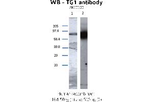 Image no. 2 for anti-Transglutaminase 1, Keratinocyte (TGM1) antibody (ABIN347015) (TGM1 抗体)