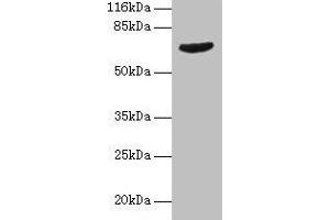 Western blot All lanes: GRK4 antibody at 2 μg/mL + Jurkat whole cell lysate Secondary Goat polyclonal to rabbit IgG at 1/10000 dilution Predicted band size: 67, 64, 58, 62 kDa Observed band size: 67 kDa (GRK4 抗体  (AA 1-245))