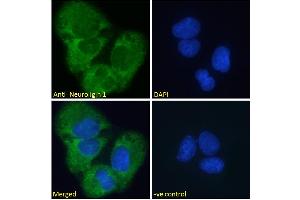 ABIN185446 Immunofluorescence analysis of paraformaldehyde fixed U2OS cells, permeabilized with 0. (Neuroligin 1 抗体  (Internal Region))