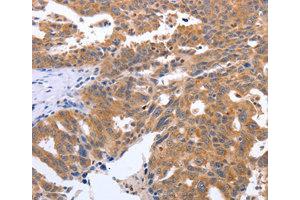 Immunohistochemistry (IHC) image for anti-Gem (Nuclear Organelle) Associated Protein 2 (GEMIN2) antibody (ABIN1872798) (SIP1 抗体)