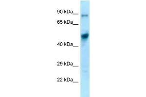 WB Suggested Anti-Eif4a1 Antibody Titration: 1. (EIF4A1 抗体  (C-Term))