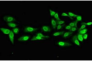 Immunofluorescent analysis of Hela cells using ABIN7168160 at dilution of 1:100 and Alexa Fluor 488-congugated AffiniPure Goat Anti-Rabbit IgG(H+L) (PRPS2 抗体  (AA 11-106))