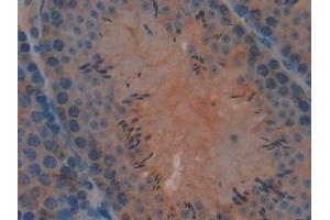 Immunohistochemistry (IHC) image for anti-Growth Factor Receptor-Bound Protein 7 (GRB7) (AA 298-489) antibody (ABIN7439495)