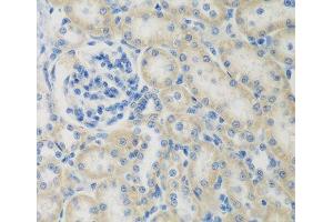 Immunohistochemistry of paraffin-embedded Rat kidney using CCL26 Polyclonal Antibody at dilution of 1:200 (40x lens). (CCL26 抗体)