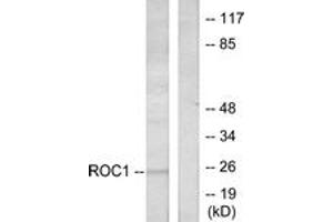 Western blot analysis of extracts from Jurkat cells, using RIT1 Antibody. (RIT1 抗体  (AA 170-219))