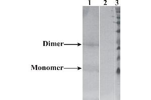 Western-Blot detection of human NRTN expressed in CHO cells. (Neurturin 抗体)