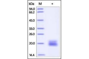 Mouse VEGF120 on SDS-PAGE under reducing (R) condition. (VEGF Protein (AA 27-146))