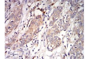 Immunohistochemistry (IHC) image for anti-Complement Component 1, Q Subcomponent, A Chain (C1QA) (AA 23-167) antibody (ABIN5542307)