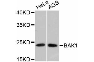 Western blot analysis of extracts of various cell lines, using BAK1 antibody (ABIN4903006). (BAK1 抗体)
