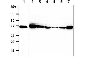 The cell lysates (40ug) were resolved by SDS-PAGE, transferred to PVDF membrane and probed with anti-human CPOX antibody (1:500). (CPOX 抗体)