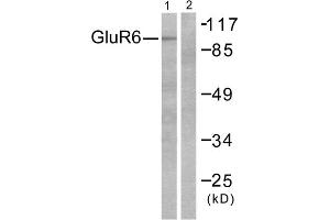 Western blot analysis of extracts from mouse brain, using GluR6 antibody (ABIN5976413). (Metabotropic Glutamate Receptor 6 抗体  (C-Term))