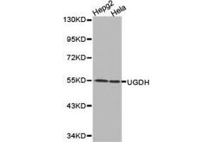 Western Blotting (WB) image for anti-UDP-Glucose 6-Dehydrogenase (UGDH) antibody (ABIN1875273) (UGDH 抗体)