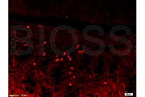 Formalin-fixed and paraffin embedded mouse kidney tissue labeled with Rabbit Anti-L-Selectin/CD62L Polyclonal Antibody (ABIN736716), Unconjugated 1:200 followed by conjugation to the secondary antibody and DAB staining (L-Selectin 抗体  (AA 301-372))