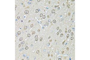 Immunohistochemistry (Paraffin-embedded Sections) (IHC (p)) image for anti-Proteasome (Prosome, Macropain) Subunit, beta Type, 1 (PSMB1) (AA 29-241) antibody (ABIN6146309)