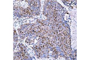 IHC analysis of p57 Kip2/CDKN1C using anti-p57 Kip2/CDKN1C antibody (ABIN7603232). (CDKN1C 抗体  (N-Term))