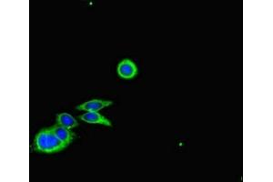 Immunofluorescent analysis of HepG2 cells using ABIN7148044 at dilution of 1:100 and Alexa Fluor 488-congugated AffiniPure Goat Anti-Rabbit IgG(H+L) (Cofilin 抗体  (AA 4-144))