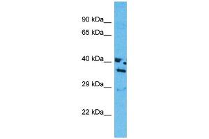 Western Blotting (WB) image for anti-Olfactory Receptor, Family 13, Subfamily J, Member 1 (OR13J1) (C-Term) antibody (ABIN2791823) (OR13J1 抗体  (C-Term))