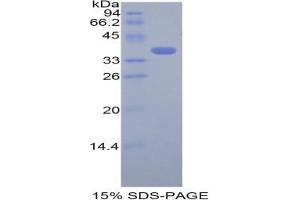 SDS-PAGE analysis of Mouse Cystatin A Protein. (CSTA 蛋白)