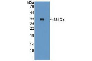 Western blot analysis of recombinant Human PIK3Cd. (PIK3CD 抗体  (AA 774-1044))