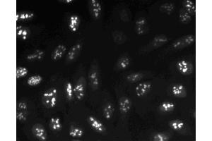 Immunofluorescent staining of U-2 OS (ATCC HTB-96) cells. (Ki-67 抗体  (AA 1547-1742))