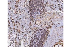 IHC analysis of HLA-DRA using anti-HLA-DRA antibody (ABIN7600950). (HLA-DRA 抗体  (AA 26-254))