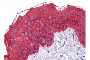 Immunohistochemical analysis of paraffin-embedded human Skin tissues using CK mouse mAb (Cytokeratin 1 抗体)