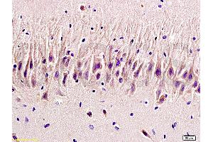 Formalin-fixed and paraffin embedded rat brain labeled with Rabbit Anti 5-HTR2A/HTR2A Polyclonal Antibody, Unconjugated (ABIN737016) at 1:200 followed by conjugation to the secondary antibody and DAB staining (HTR2A 抗体  (AA 65-160))
