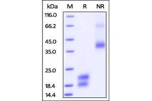 SDS-PAGE (SDS) image for Vascular Endothelial Growth Factor (VEGF) (AA 27-147) (Active) protein (AVI tag,His tag,Biotin) (ABIN2870566)
